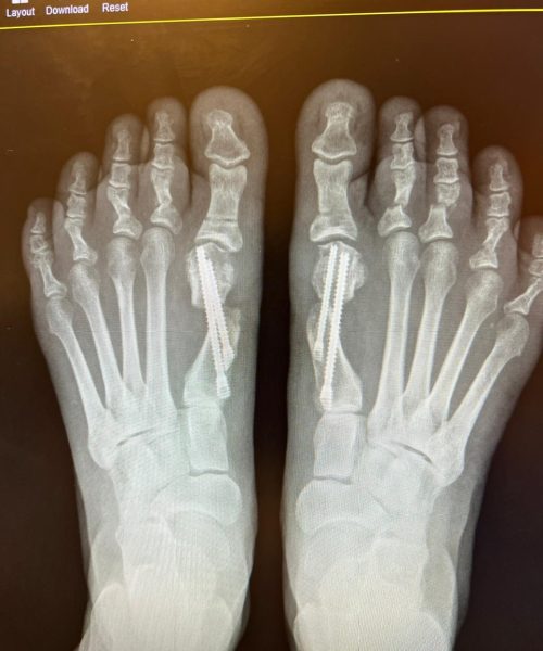 cirurgia mimamente invasiva