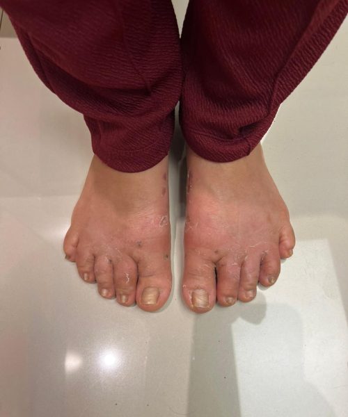 cirurgia mimamente invasiva