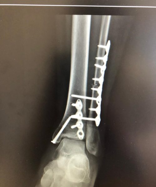 Imagem do WhatsApp de 2023-10-24 à(s) 09.37.43_8684debb