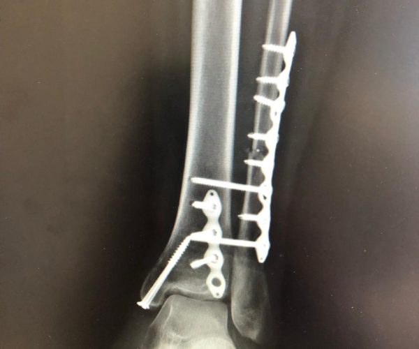 Imagem do WhatsApp de 2023-10-24 à(s) 09.37.43_8684debb