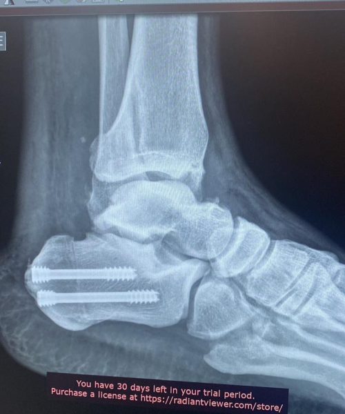 Imagem do WhatsApp de 2024-01-08 à(s) 16.53.20_a70e6eab